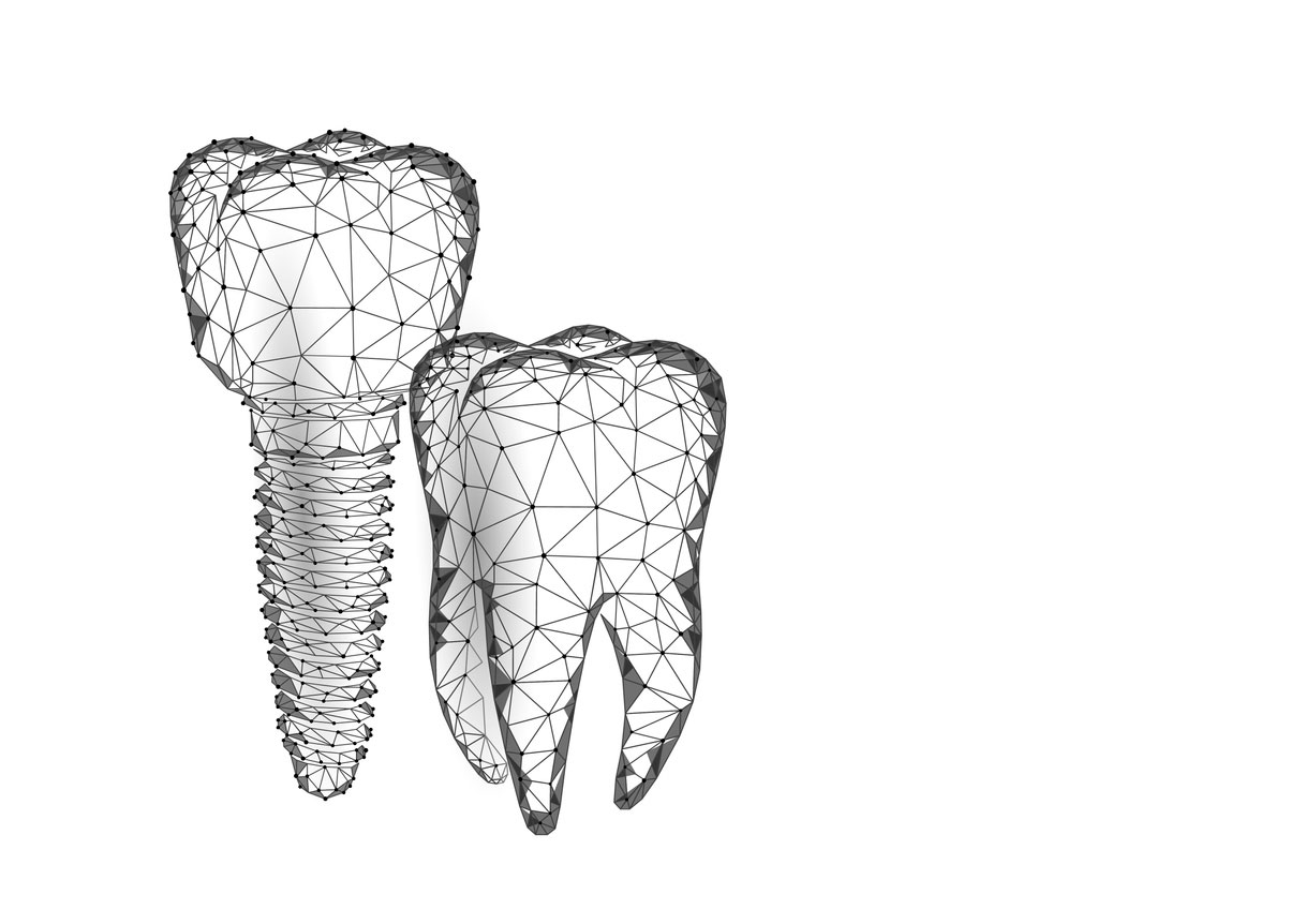 Implantati